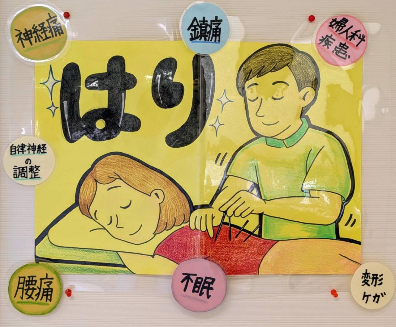 【初回】鍼施術